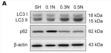 SQSTM1/p62 Antibody - Fig.