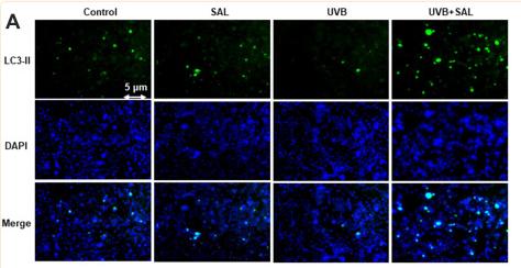 LC3B Antibody - Figure 3
Effect of SAL on autophagy and related proteins in HaCaT cells.