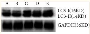 LC3A/B Antibody - Figure 7
Difference in the expression levels of LC3 proteins: A: normal control group, B: normal administration group, C: diabetes control group, D: early administration group, and E: late administration group.