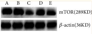 mTOR Antibody - Figure 4
Difference in the expression levels of mTOR proteins: A: normal control group, B: normal administration group, C: diabetes control group, D: early administration group, and E: late administration group.