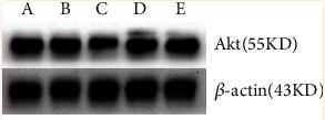 beta Actin Antibody - Figure 6
Difference in the expression levels of Akt proteins: A: normal control group, B: normal administration group, C: diabetes control group, D: early administration group, and E: late administration group.