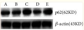 SQSTM1/p62 Antibody - Figure 5
Relative expression levels of p62 protein in the ventricles of rats in each group: A: normal control group, B: normal administration group, C: diabetes control group, D: early administration group, and E: late administration group.