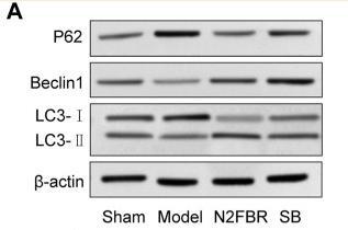 LC3A/B Antibody - FIGURE 5
Effects of N2FBR on autophagy.