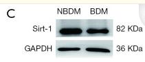 SirT1 Antibody - Figure 6
MiR-29a promoted cell proliferation and invasion in breast cancer with type 2 diabetes mellitus (BDM) by targeting SIRT1.
