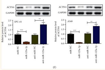 GAPDH Antibody - Figure 3
ACTN4 targets on miR-125a-3p via TP73-AS1.