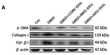 TGF beta 1 Antibody - FIGURE 5 Evaluation of corporal fibrosis in the corpus cavernosum.