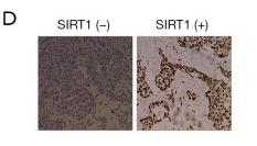 SirT1 Antibody - Figure 6
MiR-29a promoted cell proliferation and invasion in breast cancer with type 2 diabetes mellitus (BDM) by targeting SIRT1.