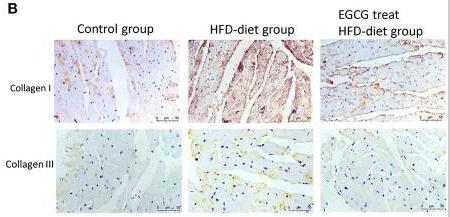 Collagen I Antibody - Figure 2
EGCG alleviated the pathology of obesity-induced myocardial fibrosis.