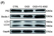GAPDH Antibody - FIGURE 2
FG‐4592 inhibits apoptosis and promotes autophagy in bone marrow stromal cell (BMSC) post‐oxygen–glucose deprivation (OGD).