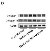Collagen I Antibody - Figure 2
EGCG alleviated the pathology of obesity-induced myocardial fibrosis.