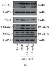 TGF beta 1 Antibody - Figure 4
LrB suppressed the expression of PAI-1 and the activation of TGF-β1/Smad signaling pathway in MI/R mice.