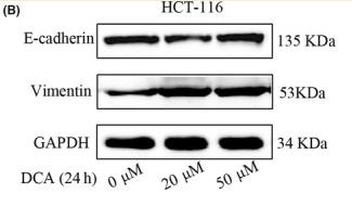 GAPDH Antibody - FIGURE 7
Deoxycholic acid (DCA) accelerated vasculogenic mimicry formation, epithelial‐mesenchymal transition, and migration in HCT‐116 cells.