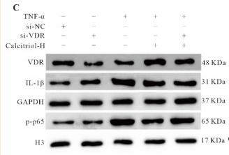 GAPDH Antibody - Figure 6
Importance of VDR in calcitriol-regulated inflammatory cytokines expressions.