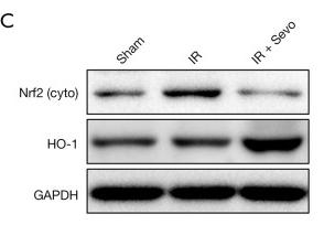 GAPDH Antibody - Figure 6
The effect of sevoflurane on the protein expression of p53 and Nrf2 in liver tissue induced by IR.