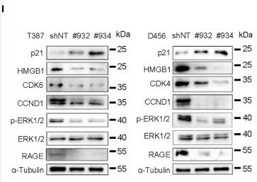 ERK1/2 Antibody - Figure 4
HMGB1 promotes cell cycle progression via RAGE-dependent ERK1/2 signaling pathway in GSCs

(A) qPCR analysis of RAGE, TLR2, and TLR4 mRNA levels in GSCs under hypoxia for 24 h.