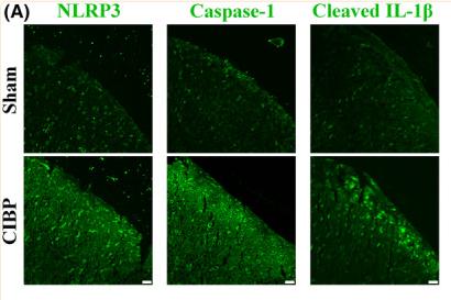 Cleaved-IL-1 beta (Asp116) Antibody - FIGURE 5
Effects of TDZD‐8 on spinal NLRP3 inflammasome cascade.