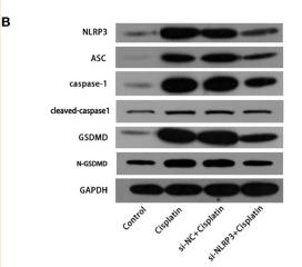 GSDMD Antibody - Figure 5
The expression differences of key molecules in NLRP3 inflammasome-mediated pyrolysis (NLRP3, ASC, caspase-1, IL-1β, and GSDMD) in mRNA level (A) and in protein level (B) in the control, cisplatin, cisplatin+siNC, and cisplatin+siNLRP3 groups.