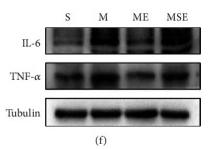 IL6 Antibody - Figure 2
EA upregulated the expression of miR-206-3p and inhibited the expression of the target gene BDNF, while decreasing the expression of BAX/Bcl-2, IL-6, and TNF-α after CCI.