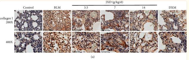 Collagen I Antibody - Figure 6
The effect of JXD on the expression of collagen I and α-SMA in lung tissue of BLM-induced rats.