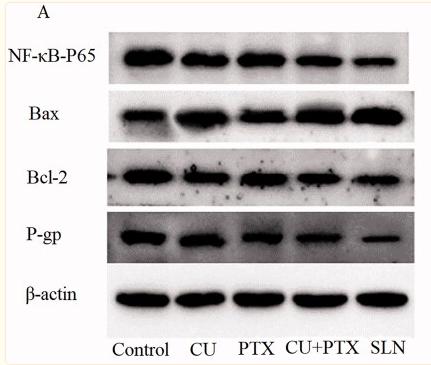 NF-kB p65 Antibody - Figure 5.