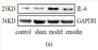 IL6 Antibody - Figure 12
Protein expression levels of IL-6 and Hif-1α in cerebral infarction tissues of rats in each group.