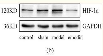 HIF1A Antibody - Figure 12
Protein expression levels of IL-6 and Hif-1α in cerebral infarction tissues of rats in each group.