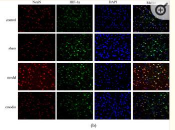 HIF1A Antibody - Figure 13
Immunofluorescence images and quantitative analysis of VEGF-A and Hif-1α.