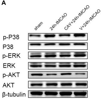 ERK1/2 Antibody - FIGURE 8
S1PR3 inhibition changes the levels of Akt, p38, and ERK1/2 phosphorylation.