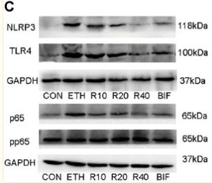 GAPDH Antibody - FIGURE 3
Effect of ROF on CYP2E1 protein and TLR4/NF-κB axis in mice.