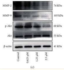beta Actin Antibody - Figure 4
Anlotinib inhibits the migration of HSC-3 cells by suppressing the activation of the Akt pathway.
