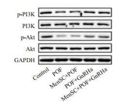GAPDH Antibody - 4
小鼠卵巢颗粒细胞中p-PI3K、PI3K、p-Akt及Akt蛋白表达情况

Protein expression of p-PI3K, PI3K, p-Akt, and Akt in ovarian granulosa cells in different groups (Mean±SD, n=3).