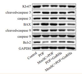 Cleaved-Caspase 9 (Asp353) Antibody - 3
小鼠卵巢颗粒细胞中KI-67、Bcl-2、BAX、Cleaved-Caspase 9、Cleaved-Caspase 3蛋白表达情况

Protein expression of Ki-67, Bcl-2, BAX, cleaved caspase 9, and cleaved caspase 3 in different groups.