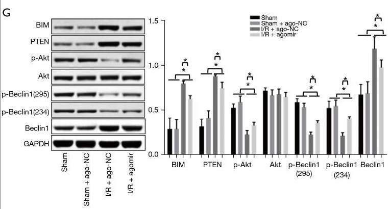 Phospho-AKT1/2/3 (Ser473) Antibody - Figure 5
The miR-17-5p agomir was administrated via the tail vein 24 h before I/R modeling (n=4 per group).