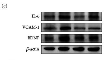 IL6 Antibody - Figure 5
DFO and EDA alleviated the inflammatory responses in EAP model.