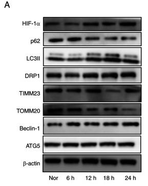 HIF1A Antibody - Figure 5
Effects of hypoxia on mitophagy in cultured HDPCs.