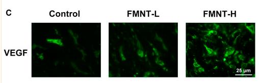 VEGFA Antibody - FIGURE 4
FMNT increased blood vessels in flaps (A) Laser Doppler images show blood perfusion in the flap (scale bar: 1 cm) The H&E staining between three groups showing the vessels (scale bar: 50 and 25 μm) (B) Signal intensity of blood flow in skin flaps among the three groups (C) The representative fluorescence image of VEGF with DAPI (nuclei) (scale bar: 25 μm) (D) Mean vessel density of mice skin flap tissue (E) The percentage of VEGF positive cells in dermal layer of skin flaps.