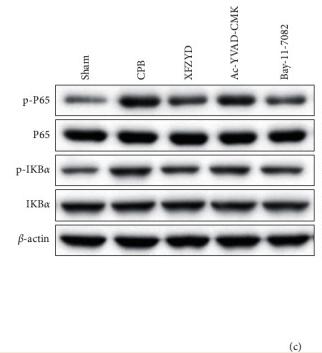 NF-kB p65 Antibody - Figure 7
XFZYD inhibited the IKBα/NF-κB signaling in rat models with CPB-induced ALI.