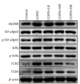 beta Actin Antibody - Figure 7
BA improved the expressions of MYD88, p–NF–κBp65/NF-κBp65, p-IκBa/IκBa, TLR2, and TLR4 in rat lung tissue.