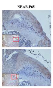 NF-kB p65 Antibody - Figure 4
mRNA and protein expression in knee joint and spleen of CIA rats.