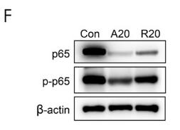 NF-kB p65 Antibody - Fig.