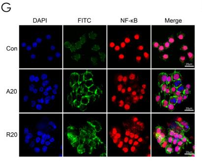 NF-kB p65 Antibody - Fig.