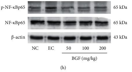 NF-kB p65 Antibody - Figure 4
The BGF effects on levels of oxidative stress-related factors and inflammasome factors.
