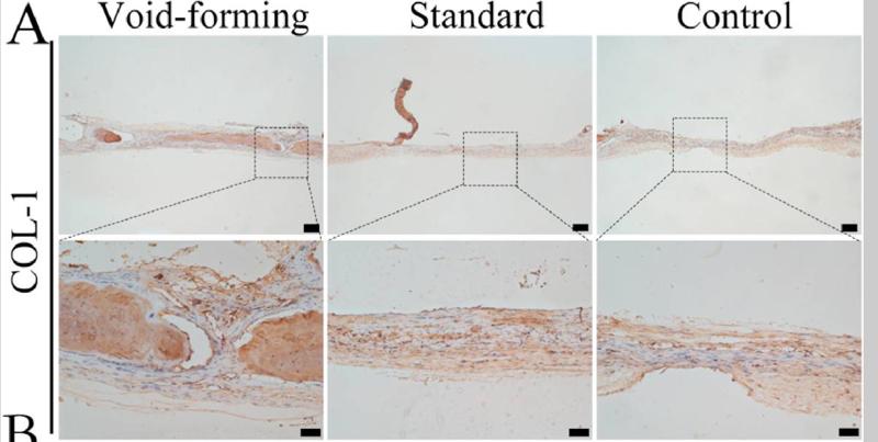 Collagen I Antibody - Fig.