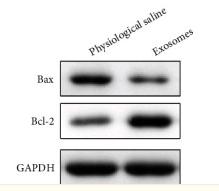 GAPDH Antibody - Figure 3
The effect of tumor-derived exosomes on pancreatic cancer (PC) on the xenograft tumor model.