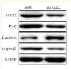 GAPDH Antibody - Figure 8
Knockdown of LAMC2 reduced the expression of LAMC2, Ki-67, and integrinβ1, while increased the expression of E-cadherin.