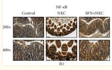 NF-kB p65 Antibody - Figure 4
Immunohistochemical staining of TLR4 (a), NF-κB (b), Bax (c), and Bcl-2 (d) and semiquantitative analysis of these proteins expression (e) in intestinal tissues of mice.