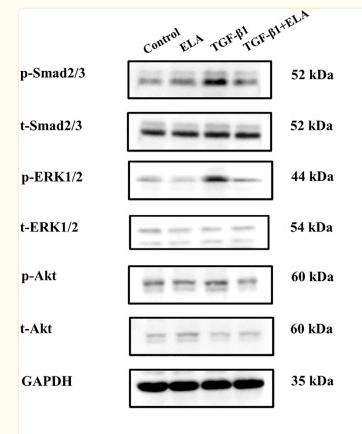 Phospho-AKT1/2/3 (Ser473) Antibody - FIGURE 4
Effects of ELA on TGF-β1-induced activation of the SMAD/ERK/AKT Pathway.