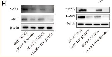 Phospho-AKT1/2/3 (Ser473) Antibody - FIGURE 7
LASP1 mediated DSY down-regulation of integrin expression in TGF-β2-treated cells.