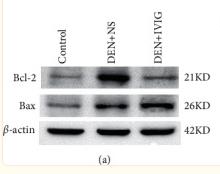 Bcl-2 Antibody - Figure 7
Western blotting detection of Bax and Bcl-2 protein expressions in rats' liver tissues in each group at the end of the experiment.