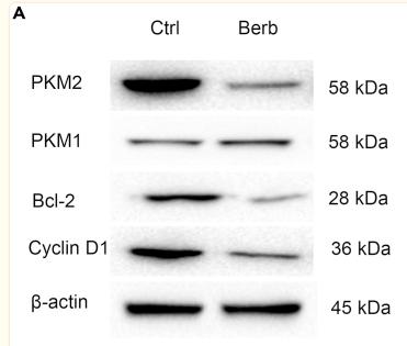 Bcl-2 Antibody - Figure 4
Direct binding of berberine to PKM2 promotes ubiquitination to inhibit the pathway in colorectal cancer

(A) The effect of berberine on PKM2, PKM1, Bcl-2, Cyclin D1 expression in HT29 cells was studied using Western blot analysis.